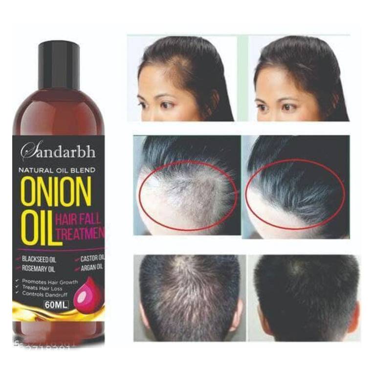 Sandarbh Onion Oil for Hair Regrowth & Hair Fall Control Hair Oil (Pack of 1)