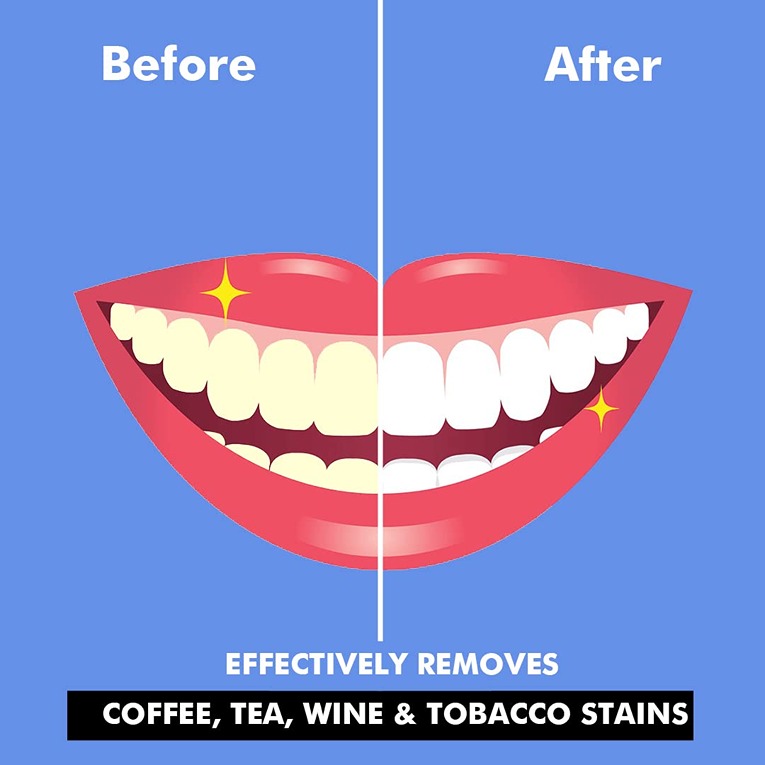 Organic Teeth Whitening White Tooth Powder For Tobacco Stain, Tartar, Gutkha Stain and Yellow Teeth Removal 50 Gm - 100% Gauranteed Results (KDB-2035018)