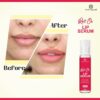 Lip Serum Roll On - Advanced Brightening Therapy for Soft, Moisturised Lips With Glossy & Shine
