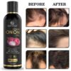 Ocean Onion oil For Hair Fall Control, Hair Growth & Hair Regrowth-Control Dandruff (100Ml)