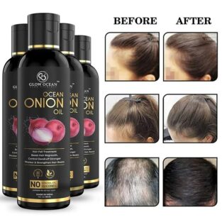 Ocean Onion oil For Hair Fall Control, Hair Growth & Hair Regrowth-Control Dandruff (400Ml)