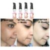 Ovetta Herbel Whiteglow Skin Whitening and Brightening Gel Cream SPF-25 30gm - Pack of 4 (KDB-2300730)