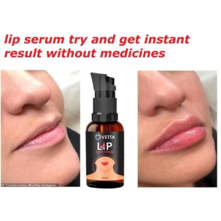 Ovetta Lip Serum For Shiny and Dry Lips-Ideal For Men and Women 30ml - Pack of 1 (KDB-2300731)