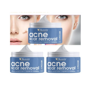 KURAIY Effective Acne Removal Cream Treatment Acne Scar Shrink Pores Oil Control Whitening Moisturize Face Pack of 3