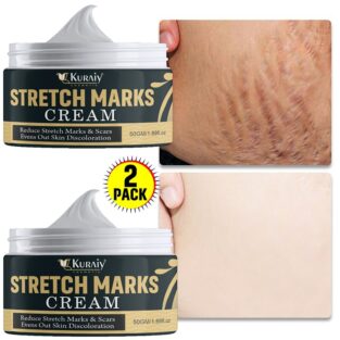 Kuraiy Pregnancy Scars Remove Stretch Marks Cream
