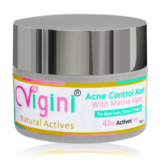 Vigini Natural Actives Acne Control Mask with Marine Algae (For Acne, Scars, Pores & Pimples) 50gm